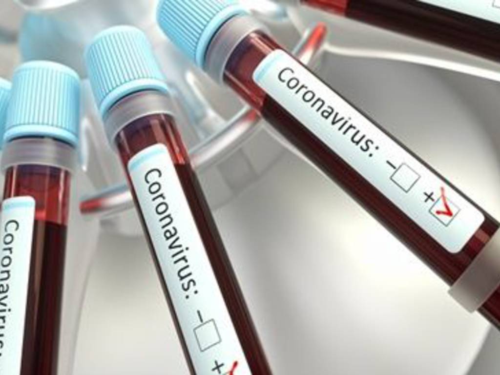 Coronavirus Positività Test