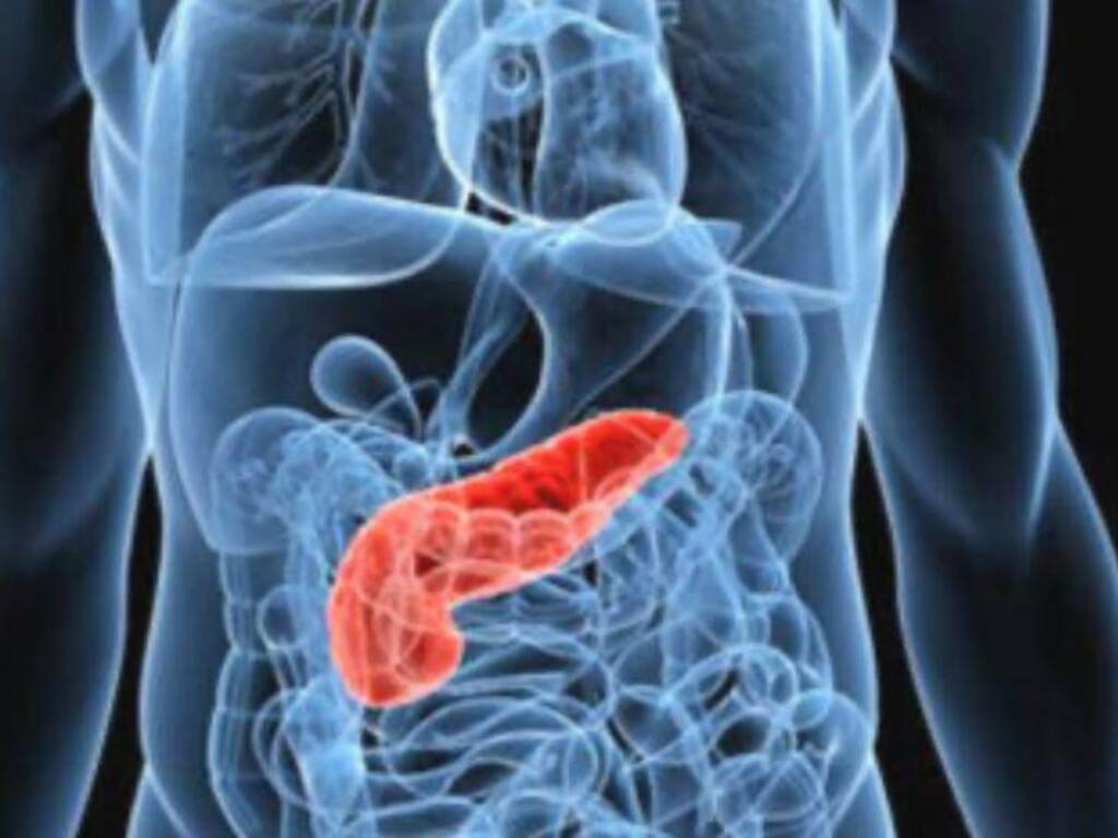 tumore del pancreas 